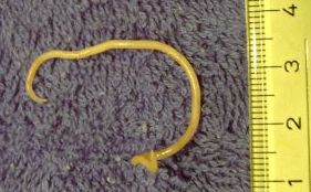 ein erwachsener Spulwurm